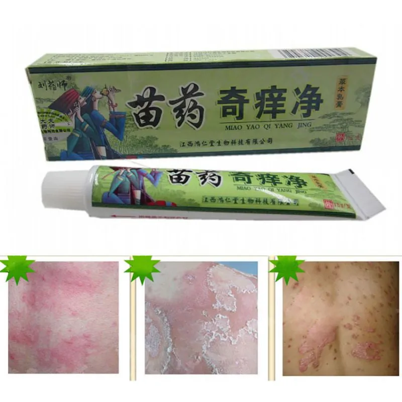 Net Herbal Itch Cream Fungal Infections Foot And Ringworm Balanitis Hemorrhoids Anti-itch Body Creams SM6