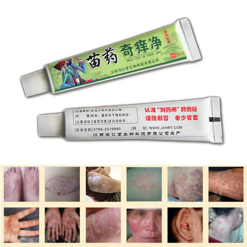 Net Herbal Itch Cream Fungal Infections Foot And Ringworm Balanitis Hemorrhoids Anti-itch Body Creams SM6